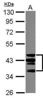 CD46 Antibody in Western Blot (WB)