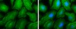 MYH9 Polyclonal Antibody
