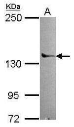 POLG Antibody in Western Blot (WB)