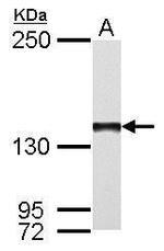 POLG Antibody in Western Blot (WB)