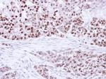 PPAR delta Polyclonal Antibody