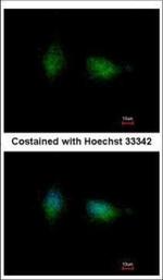 PKC beta Polyclonal Antibody
