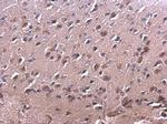 RAC2 Polyclonal Antibody