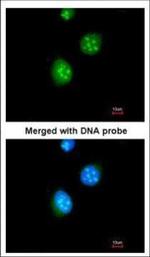 THRB Antibody in Immunocytochemistry (ICC/IF)