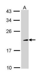 TIA-1 Antibody in Western Blot (WB)