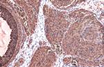 TK1 Polyclonal Antibody