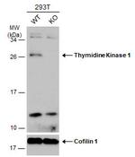 TK1 Antibody in Western Blot (WB)
