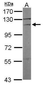 Vinculin Antibody in Western Blot (WB)