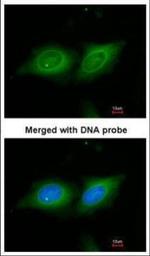 14-3-3 beta Polyclonal Antibody