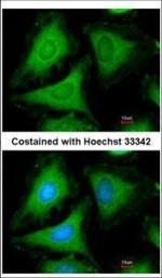 14-3-3 gamma Polyclonal Antibody