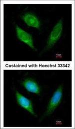AIF Polyclonal Antibody