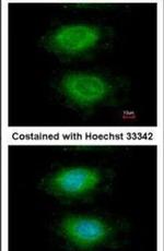AKT3 Antibody in Immunocytochemistry (ICC/IF)