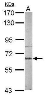 AKT3 Antibody in Western Blot (WB)