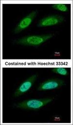 CK2 beta Antibody in Immunocytochemistry (ICC/IF)