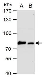 GRP78 Antibody in Western Blot (WB)