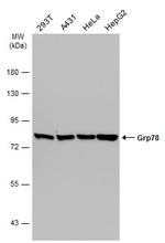 GRP78 Antibody in Western Blot (WB)