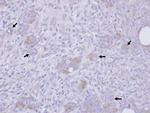 Stathmin 1 Polyclonal Antibody