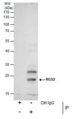 RGS2 Antibody in Immunoprecipitation (IP)