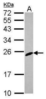 RGS2 Polyclonal Antibody