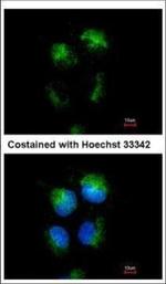 CD99 Polyclonal Antibody