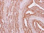 IGFBP3 Antibody in Immunohistochemistry (Paraffin) (IHC (P))