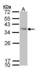 IGFBP3 Antibody in Western Blot (WB)