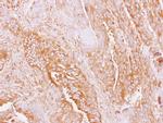 Amylin Polyclonal Antibody