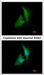 AKR1B1 Polyclonal Antibody