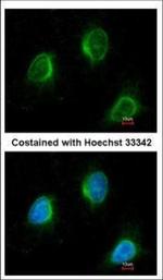 Calpain 3 Polyclonal Antibody