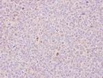 RCC1 Polyclonal Antibody
