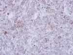CLCN2 Antibody in Immunohistochemistry (Paraffin) (IHC (P))