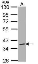 CLCN2 Antibody in Western Blot (WB)