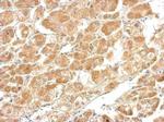 CTH Polyclonal Antibody