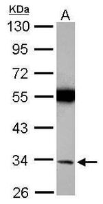 Torsin 1A Polyclonal Antibody