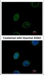 Emerin Antibody in Immunocytochemistry (ICC/IF)