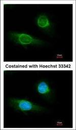 Fibrinogen gamma Polyclonal Antibody