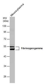 Fibrinogen gamma Antibody in Western Blot (WB)