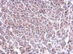 GYS1 Polyclonal Antibody