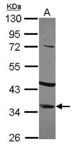 IGFBP2 Antibody in Western Blot (WB)