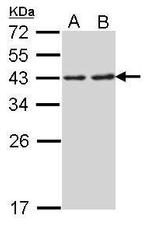 RPSA Polyclonal Antibody