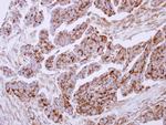Lactoferrin Polyclonal Antibody