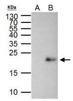 MAX Antibody in Immunoprecipitation (IP)