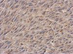 NDUFS3 Polyclonal Antibody