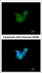 CRALBP Polyclonal Antibody