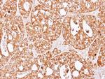 Seryl-tRNA synthetase Antibody in Immunohistochemistry (Paraffin) (IHC (P))