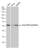 Seryl-tRNA synthetase Antibody in Western Blot (WB)