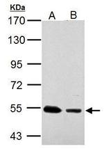 SSB Antibody in Western Blot (WB)