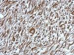 ST14 Antibody in Immunohistochemistry (Paraffin) (IHC (P))