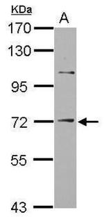 ST14 Antibody in Western Blot (WB)