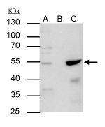 AP2 alpha Antibody in Immunoprecipitation (IP)